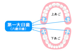 お子さんの「六歳臼歯」を大切に！